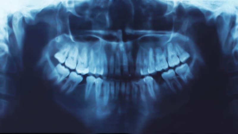 Friendly Dental of Worcester is taking new dental paitents and appointments in Worcester MA. - Friendly Dental of Worcester - Friendly Dental of Worcester Friendly Dental of Worcester is taking new dental paitents and appointments in Worcester MA.