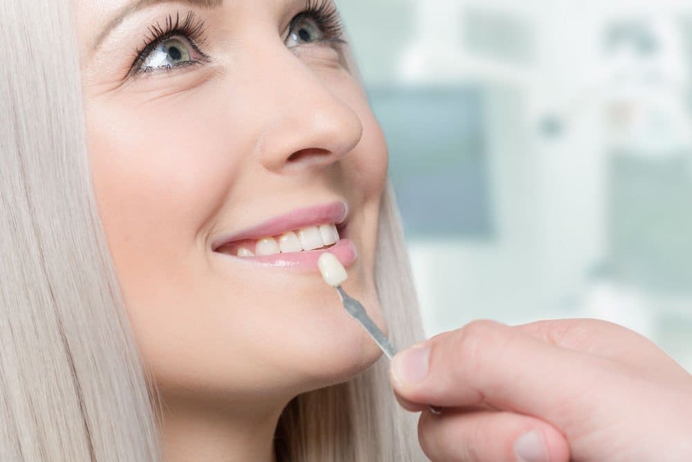 dental_veneers - Friendly Dental of Worcester - Friendly Dental of Worcester