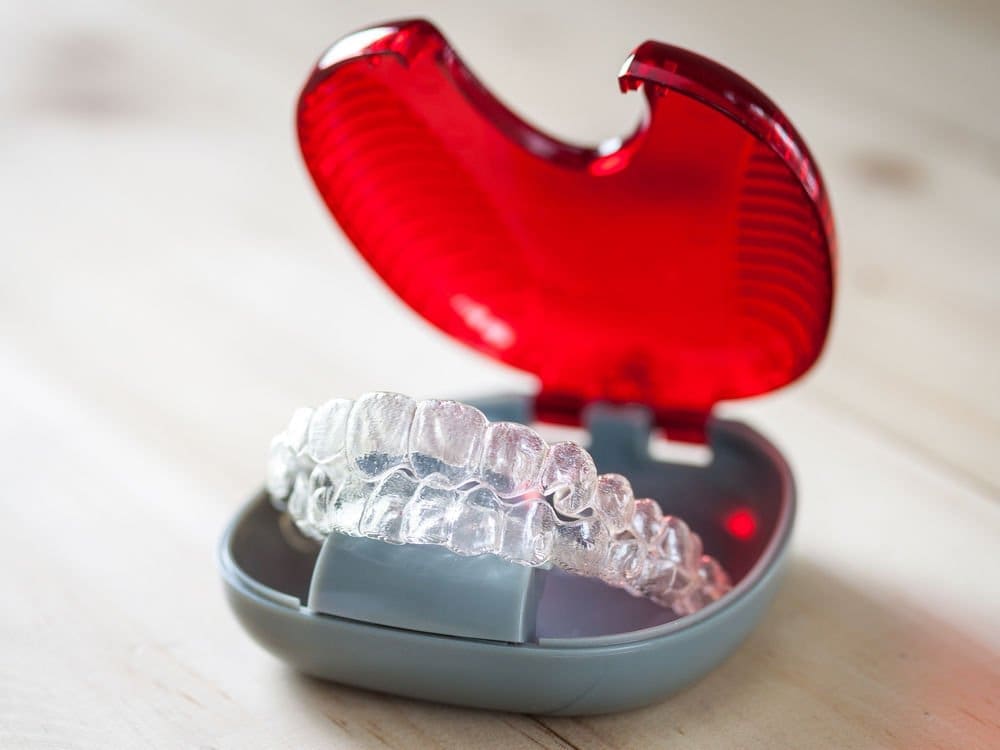 invisalign (1) - Friendly Dental of Worcester - Friendly Dental of Worcester