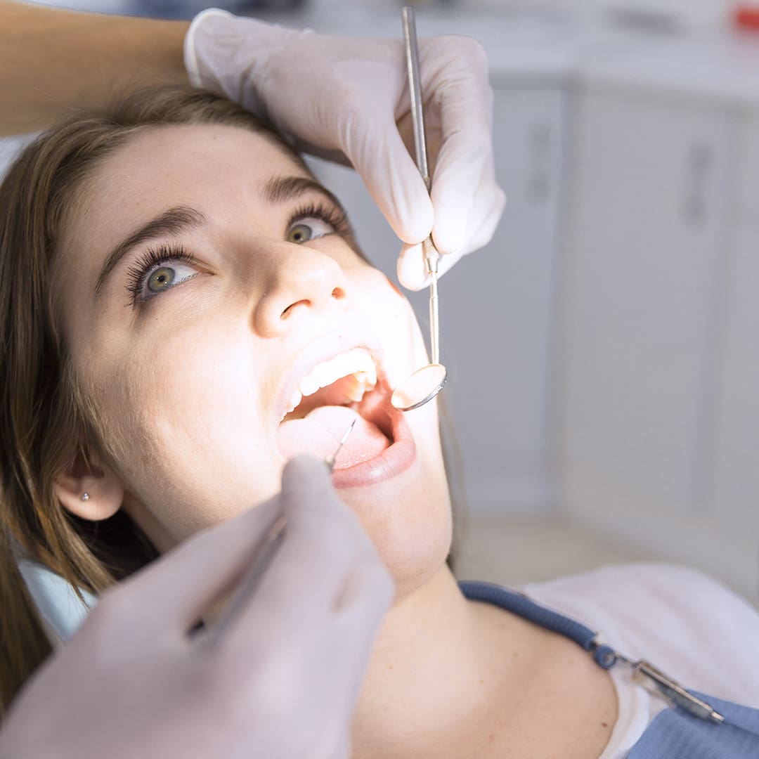 Teeth Whitening 2 - Friendly Dental of Worcester