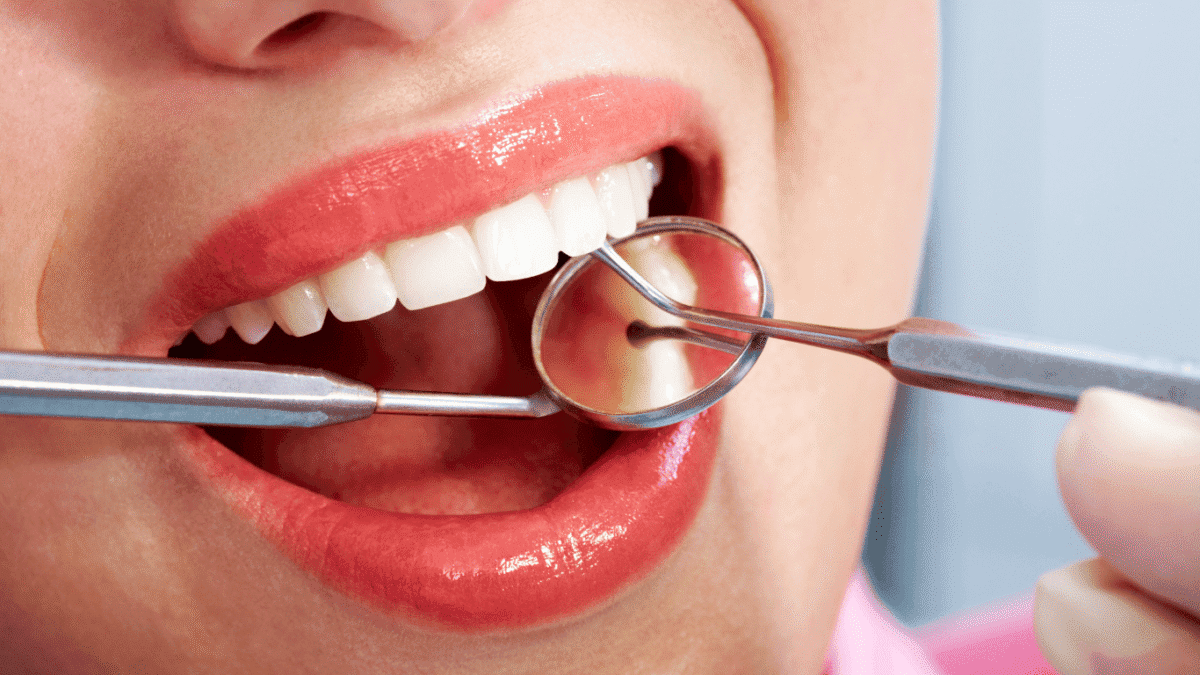 Blog (1) (1) - Friendly Dental of Worcester