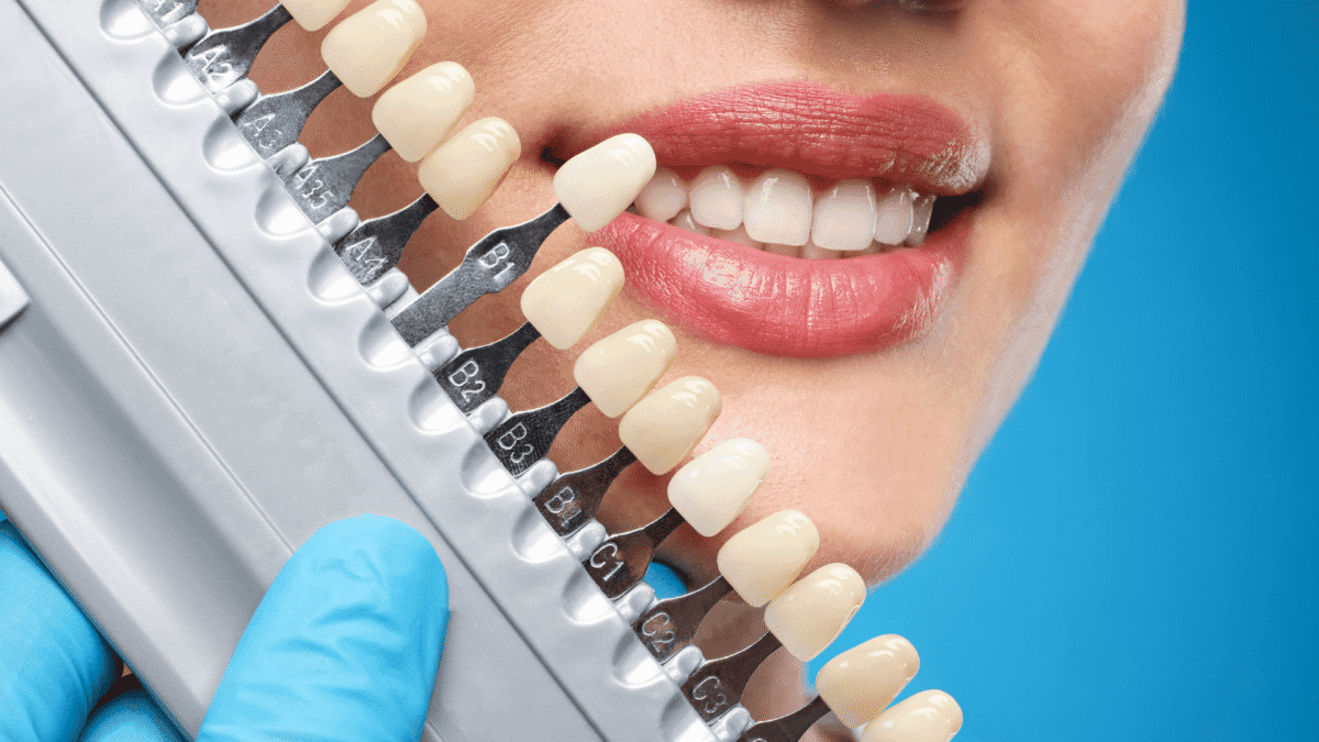 Blog (4) (1) - Friendly Dental of Worcester