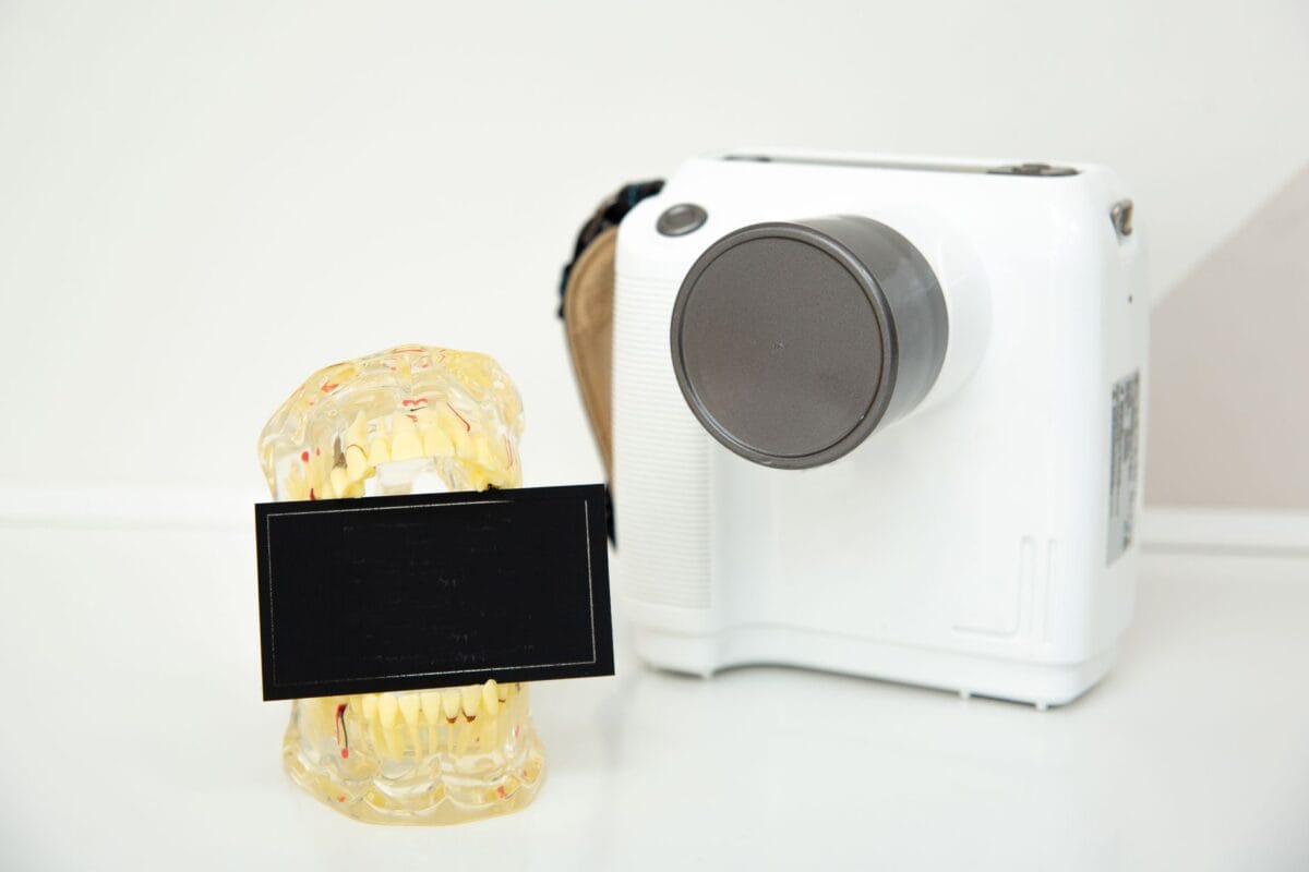 Family Cosmetic Dentistry Worcester: Modern Solutions for Better Smiles - Friendly Dental of Worcester Dental model of teeth beside a white dental imaging device on a counter; a small black chalkboard in front.