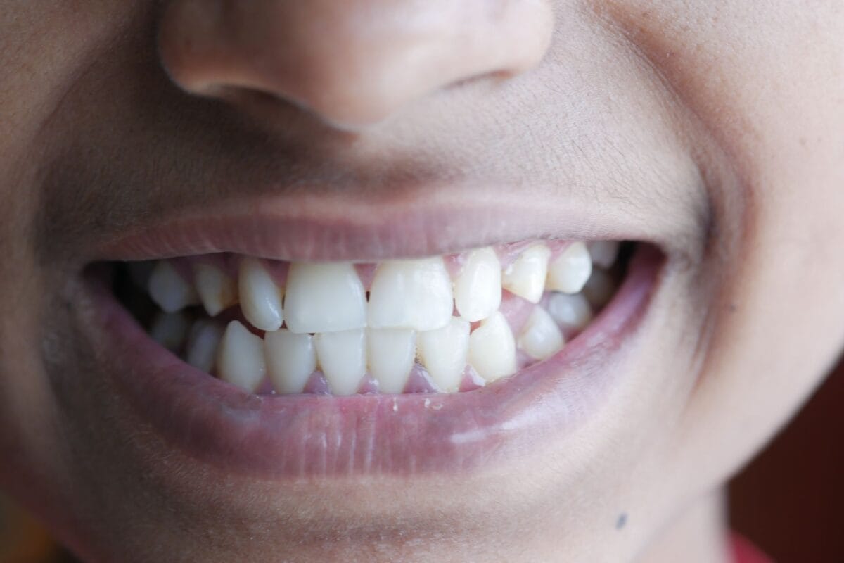 Close-up of a person smiling, showing teeth and lips in a wide grin.